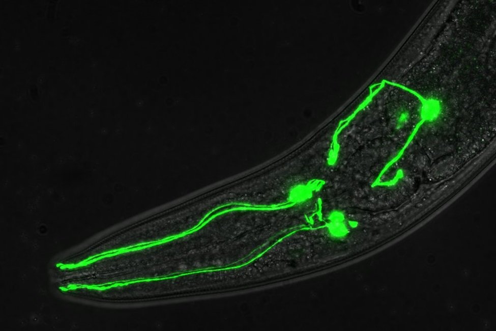 A ‘One in a Million’ Shot to Tackle Dopamine-Linked Brain Disorders